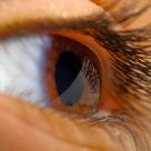 Eyein